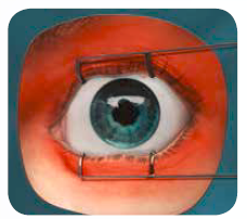 Eylea HCP